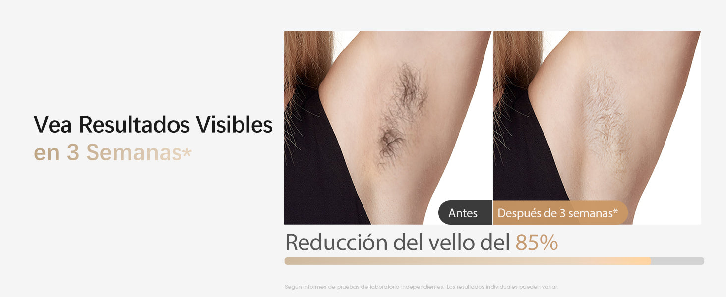Vea Resultados Visibles en 3 Semanas - Reducción del vello del 85%