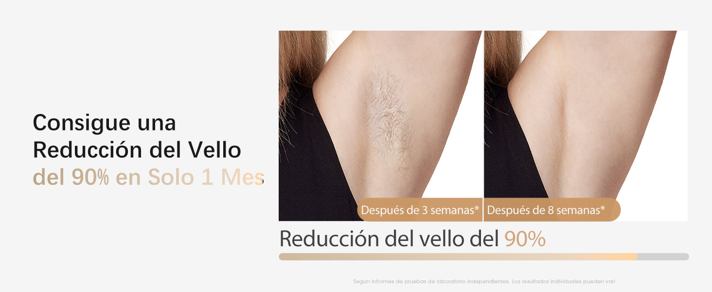 Consigue una Reducción del Vello del 90% en Solo 1 Mes - Después de 8 semanas